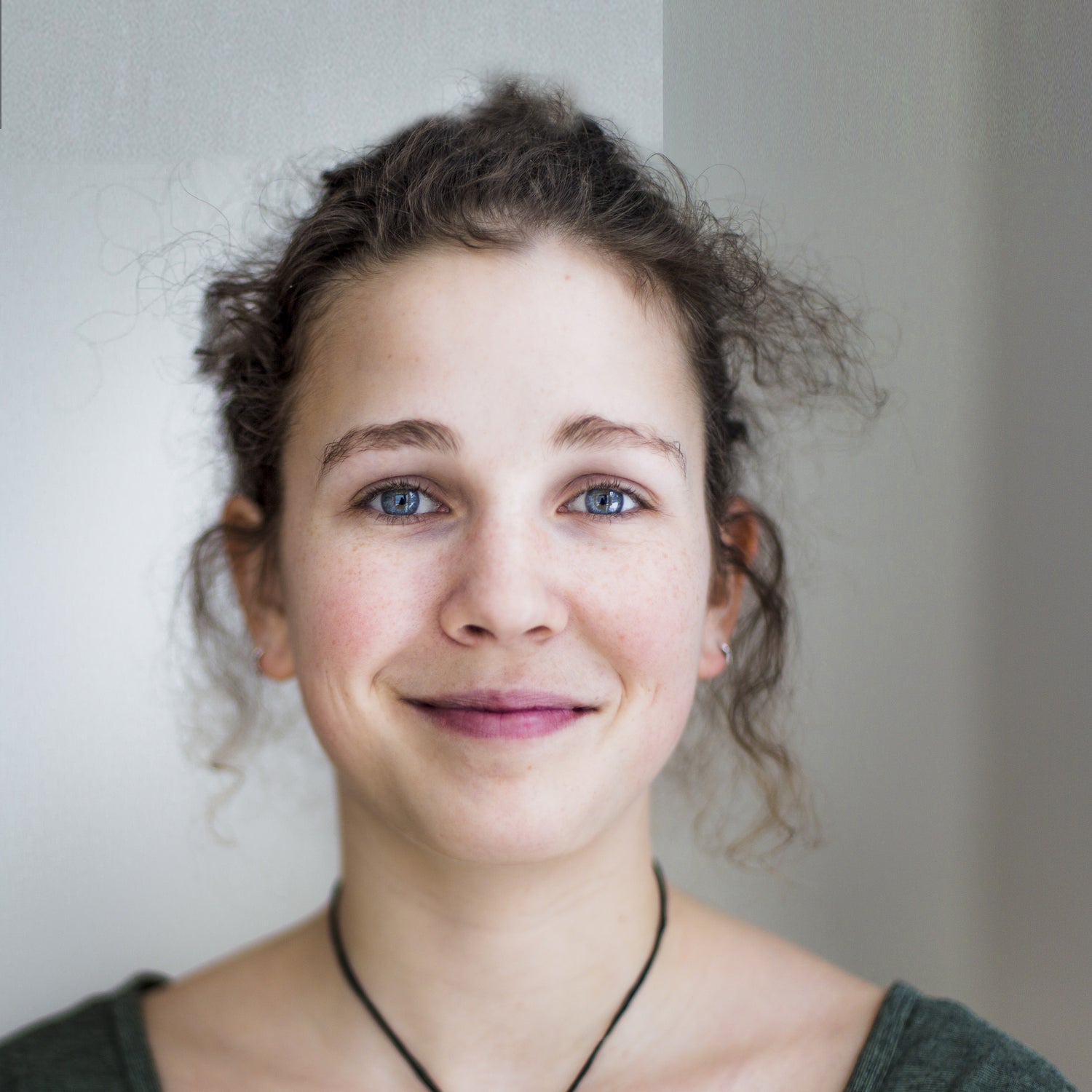 SENSITIVE FLAKY SCALP